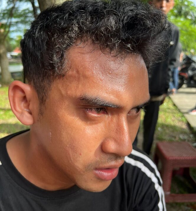 
					Kecam Tindakan Represif Aparat Terhadap Kader IMM: DPD IMM Riau Tuntut Copot Kapolda Riau dan Tindak Tegas Oknum Pelaku